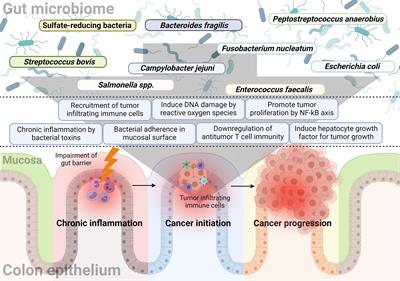 Potential Role of the Gut Microbiome In Colorectal Cancer Progression